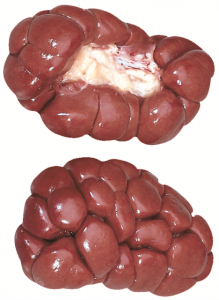 Kidney 6090